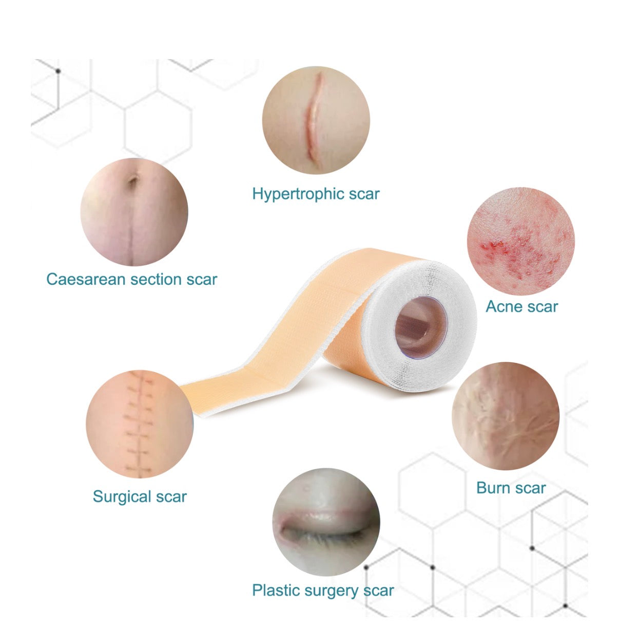 DermaLuxSA Advanced StretchMark Repair Patches – Skin Smoothing Therapy