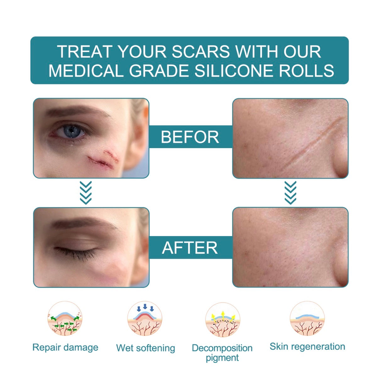 DermaLuxSA Advanced StretchMark Repair Patches – Skin Smoothing Therapy